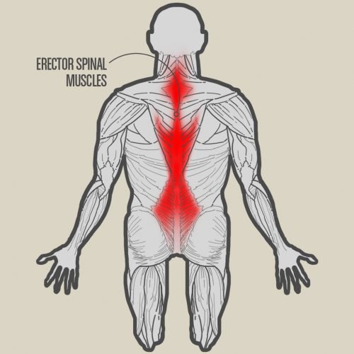 Midsection ErectorSpina