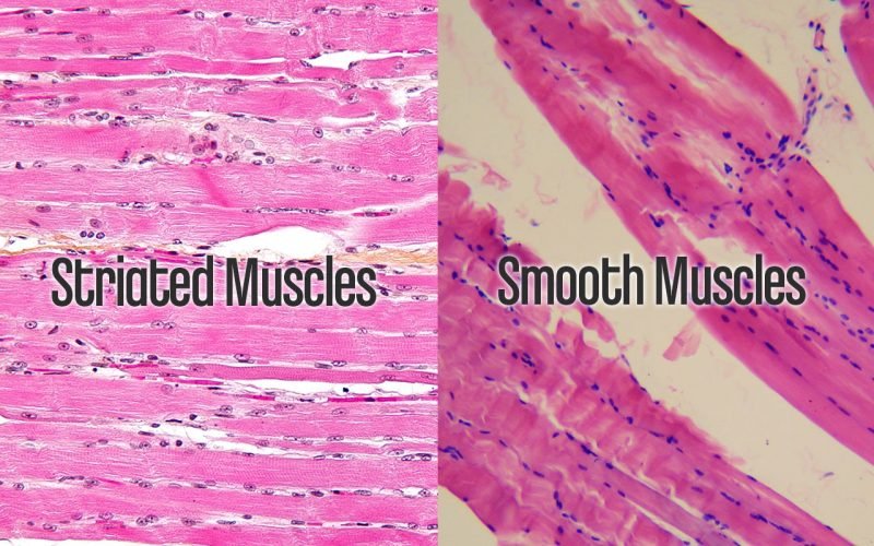 Muscles & Poor Posture - Striated Smooth Muscles