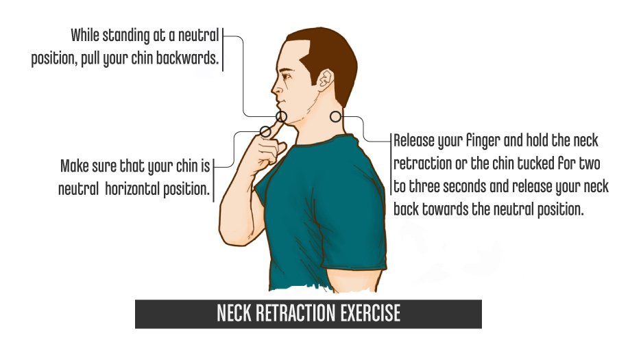 NeckRetractionExercise