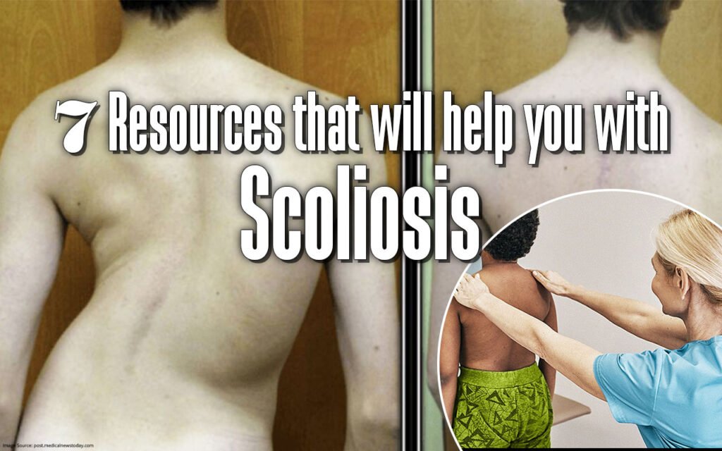 7-Resources-that-will-help-you-with-Scoliosis