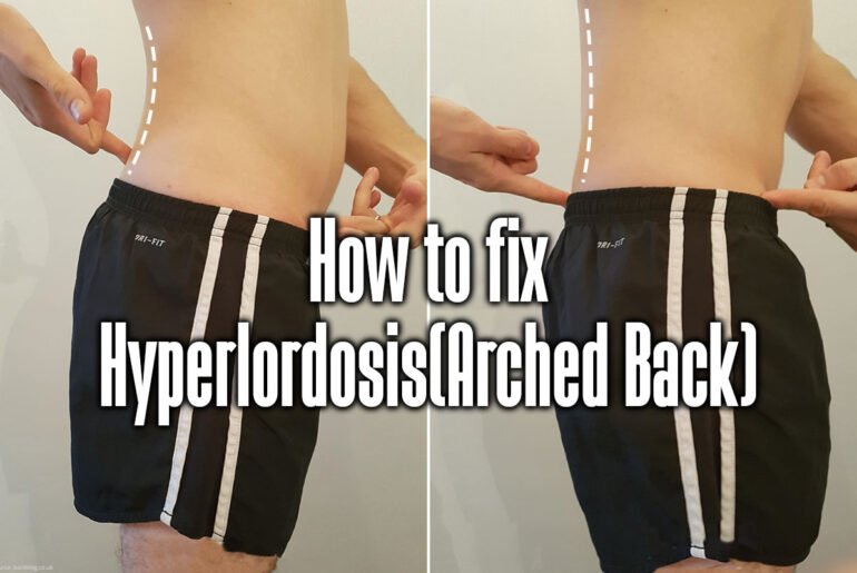 How to fix Flared Ribs - Your Body Posture
