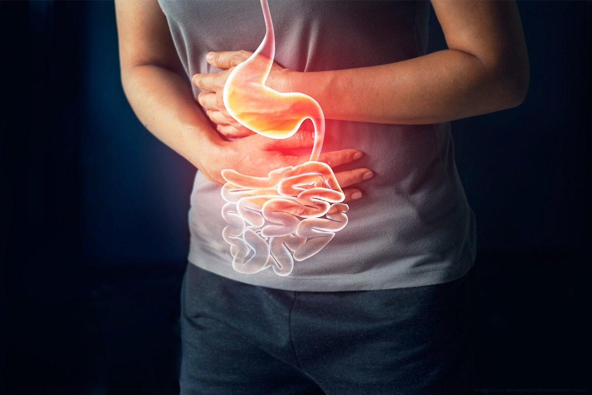 3 -Gastritis