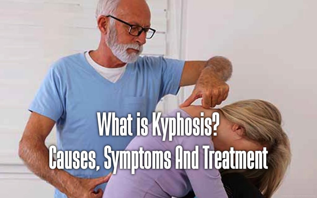 kyphosis-1