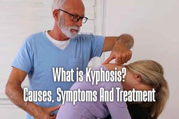 kyphosis-1