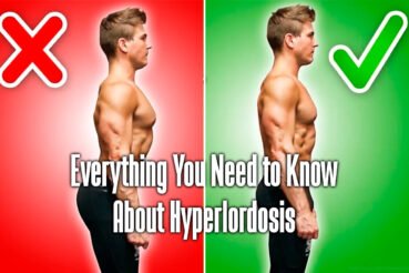 how-to-fix-hyperlordosis