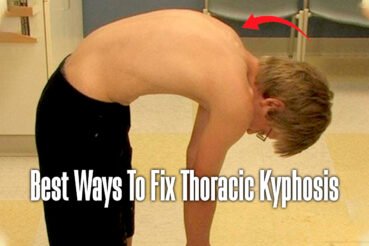 how-to-fix-thoracic-kyphosis-hunchback-posture