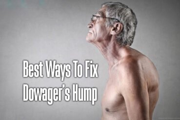 how-to-fix-a-dowagers-hump