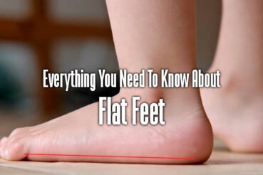how-to-fix-flat-feet