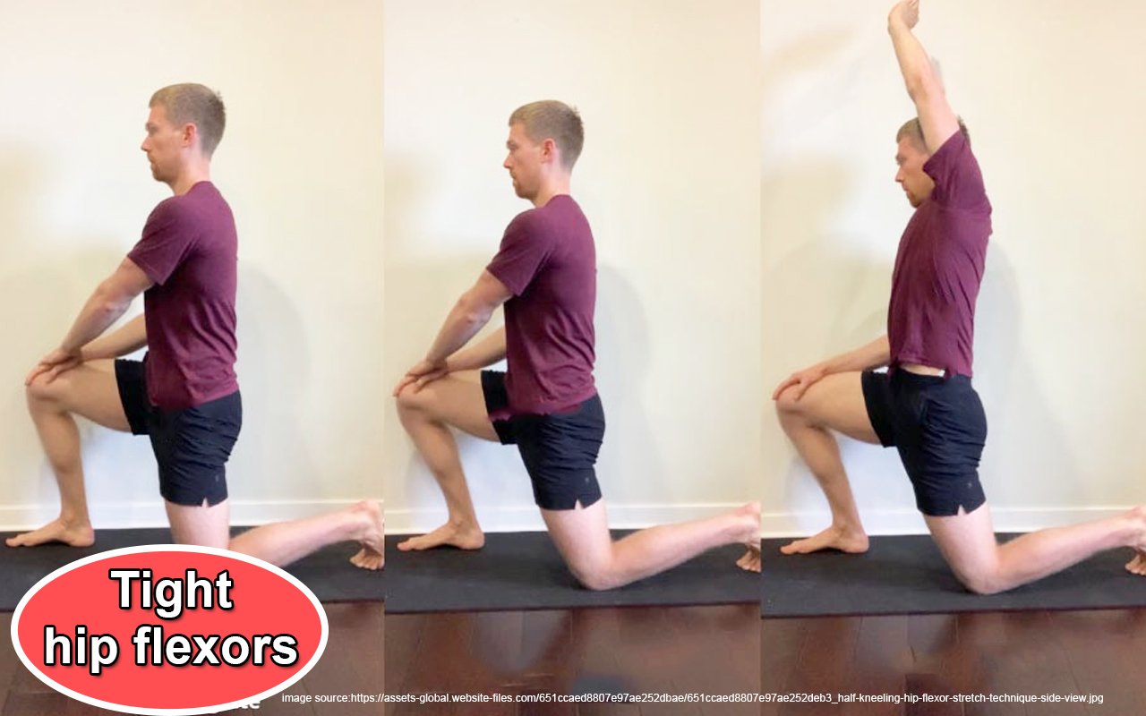 Tight hip flexors