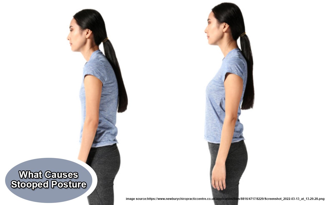 What Causes Stooped Posture?