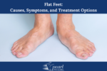 Flat-Feet-Causes-Symptoms-and-Treatment-Options